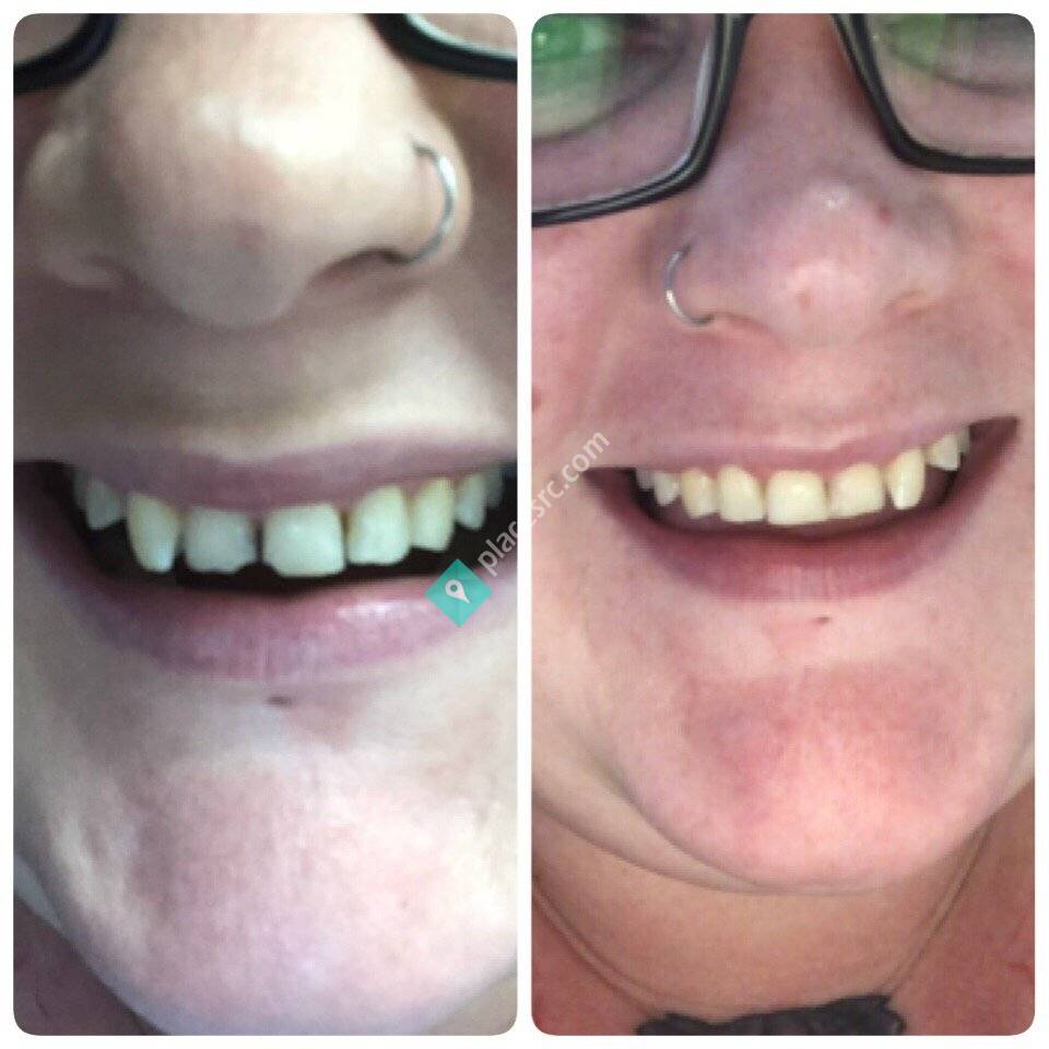 Associated Dentists Metro: Dr Michael J Flattery And Associates