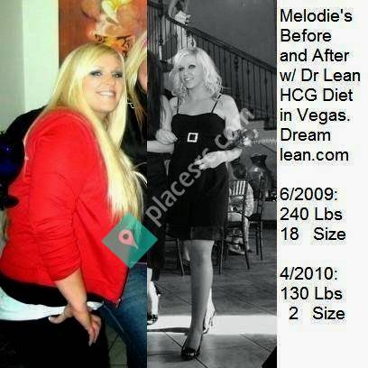 DR LEAN WEIGHT LOSS & HCG DIET CLINIC